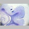 Neuronas Nissl 03.jpg